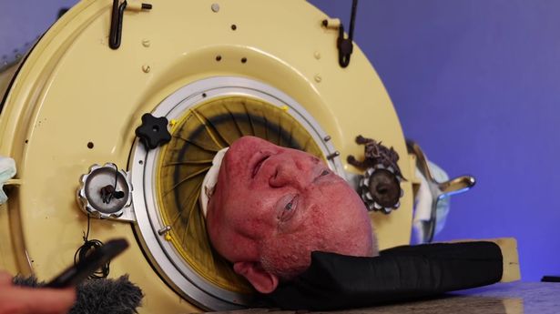 Iconic ‘Man in the Iron Lung’ Paul Alexander Dies at 78